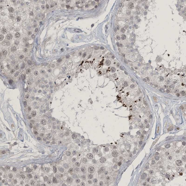 ZNF674 Antibody in Immunohistochemistry (Paraffin) (IHC (P))