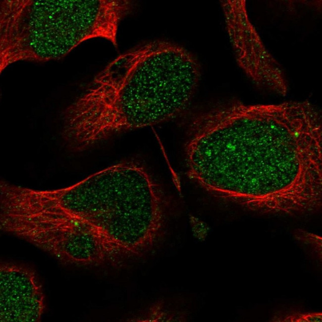 PHF1 Antibody in Immunocytochemistry (ICC/IF)
