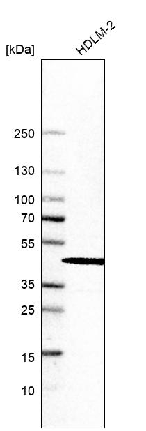 SKIP Antibody in Western Blot (WB)