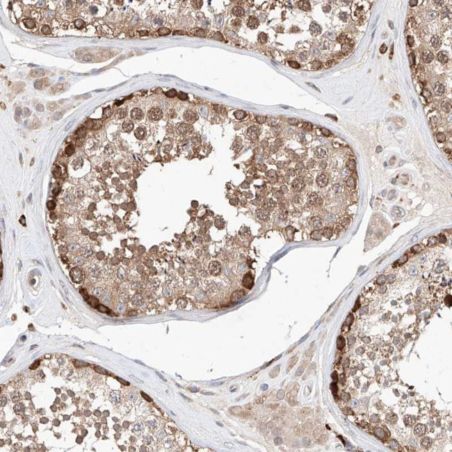 TSNAX Antibody in Immunohistochemistry (Paraffin) (IHC (P))