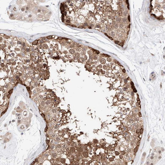 TSNAX Antibody in Immunohistochemistry (Paraffin) (IHC (P))