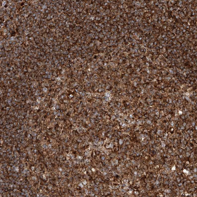 PISD Antibody in Immunohistochemistry (Paraffin) (IHC (P))