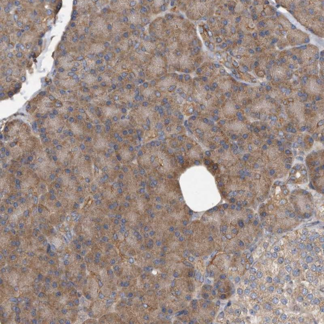DNAJC10 Antibody in Immunohistochemistry (Paraffin) (IHC (P))