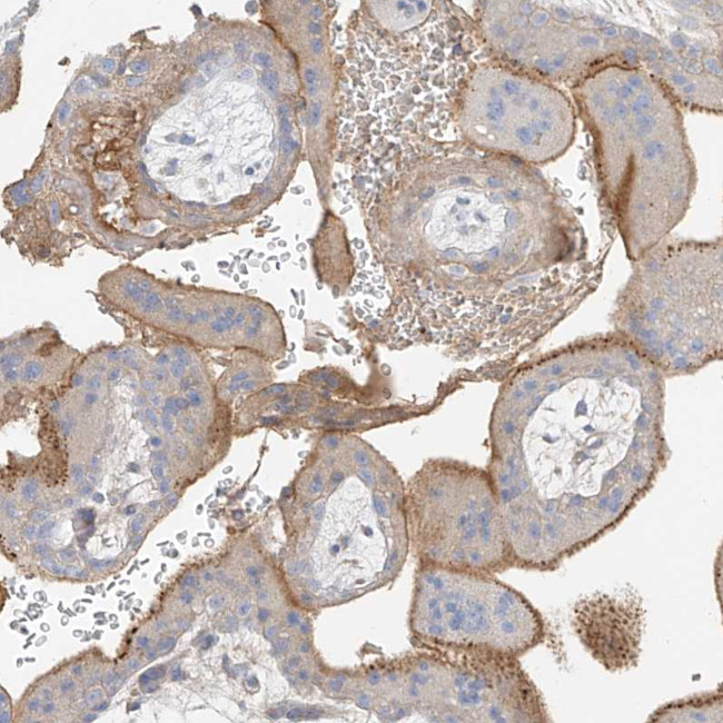 OCSTAMP Antibody in Immunohistochemistry (Paraffin) (IHC (P))