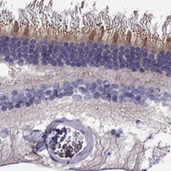 KCNV2 Antibody in Immunohistochemistry (IHC)