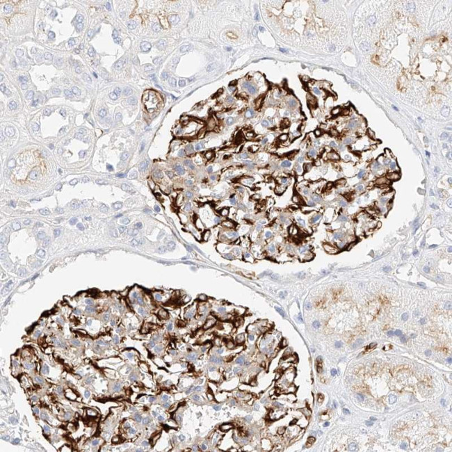CDCP2 Antibody in Immunohistochemistry (Paraffin) (IHC (P))