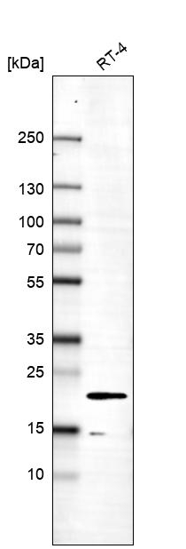 MOSPD1 Antibody in Western Blot (WB)
