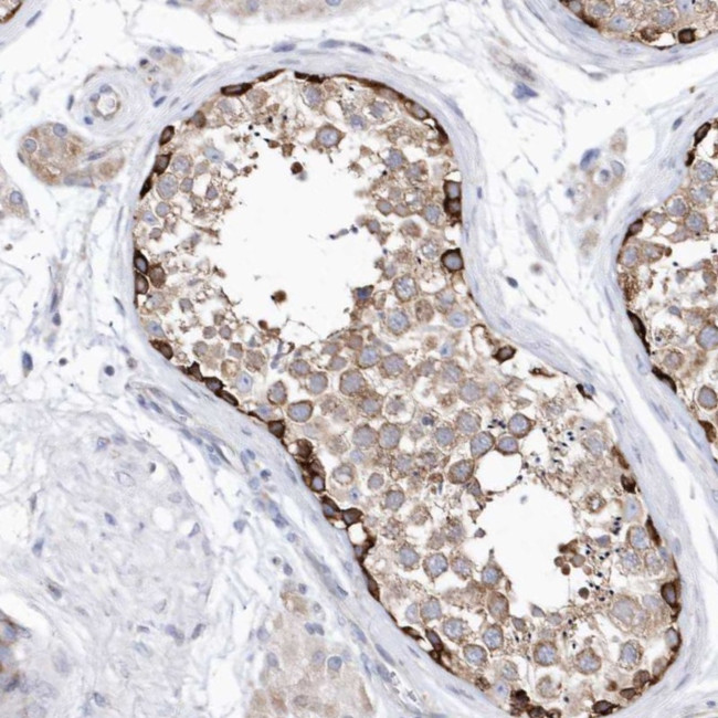 C14orf100 Antibody in Immunohistochemistry (Paraffin) (IHC (P))