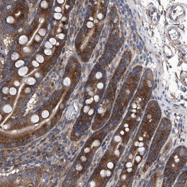KTI12 Antibody in Immunohistochemistry (Paraffin) (IHC (P))