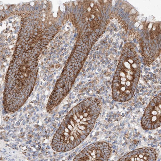KTI12 Antibody in Immunohistochemistry (Paraffin) (IHC (P))