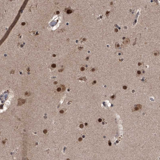 ZNF518B Antibody in Immunohistochemistry (Paraffin) (IHC (P))