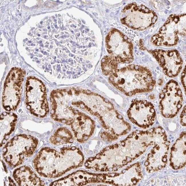PKHD1 Antibody in Immunohistochemistry (Paraffin) (IHC (P))