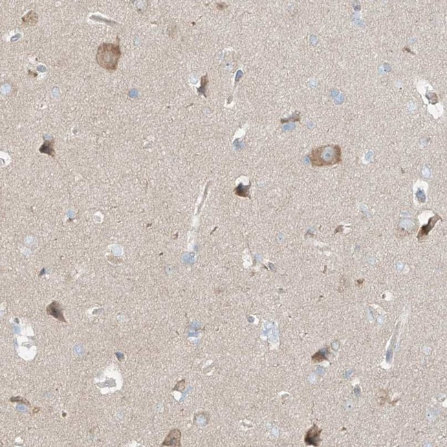 TSSC1 Antibody in Immunohistochemistry (IHC)