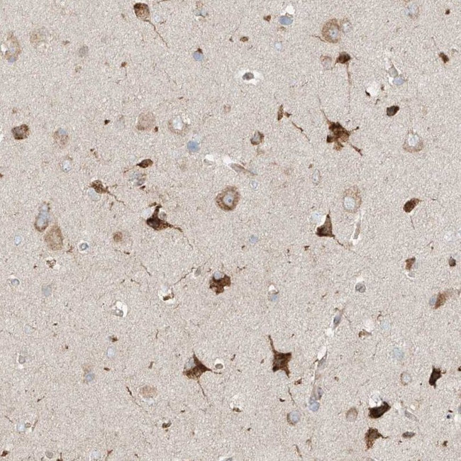 TSSC1 Antibody in Immunohistochemistry (IHC)