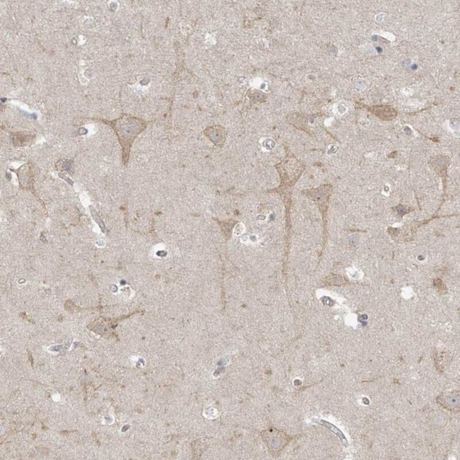 TSSC1 Antibody in Immunohistochemistry (IHC)