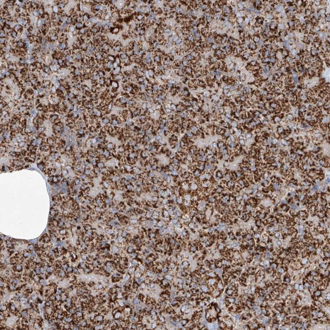TTC27 Antibody in Immunohistochemistry (Paraffin) (IHC (P))