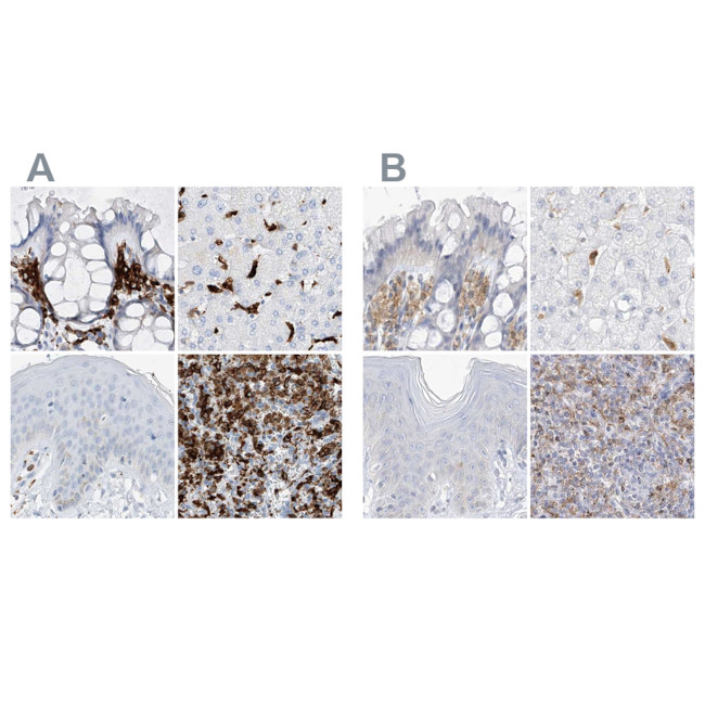 Thromboxane synthase Antibody in Immunohistochemistry (IHC)