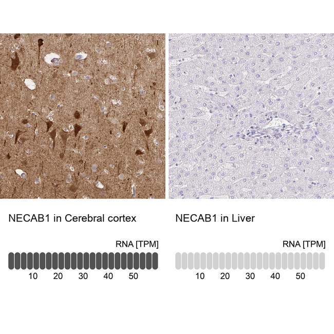 NECAB1 Antibody in Immunohistochemistry (Paraffin) (IHC (P))