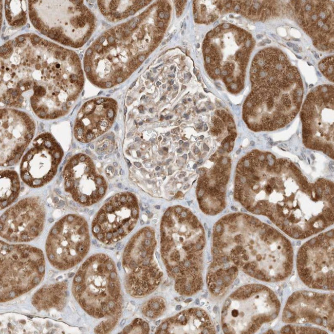 CPAMD8 Antibody in Immunohistochemistry (Paraffin) (IHC (P))