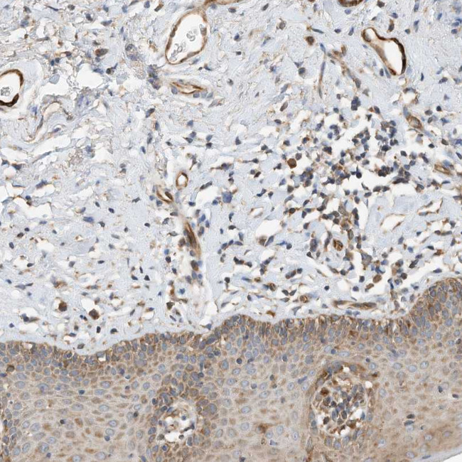 CPAMD8 Antibody in Immunohistochemistry (Paraffin) (IHC (P))