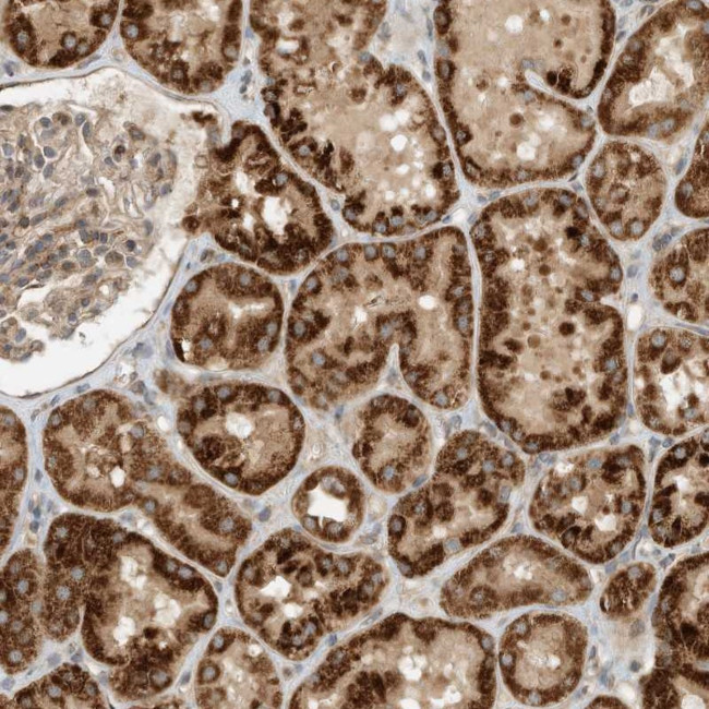 CPAMD8 Antibody in Immunohistochemistry (Paraffin) (IHC (P))