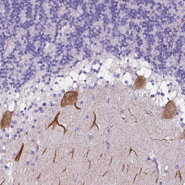 CLSTN2 Antibody in Immunohistochemistry (Paraffin) (IHC (P))