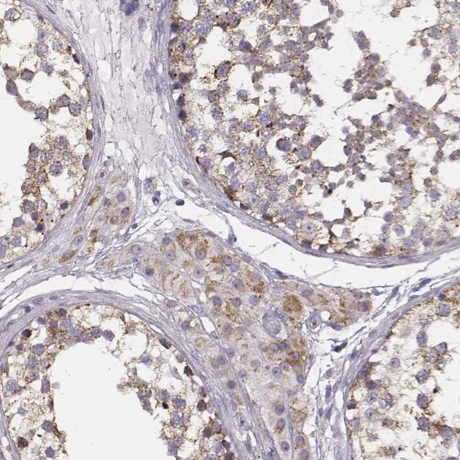 UBL4B Antibody in Immunohistochemistry (IHC)