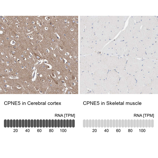 CPNE5 Antibody in Immunohistochemistry (Paraffin) (IHC (P))