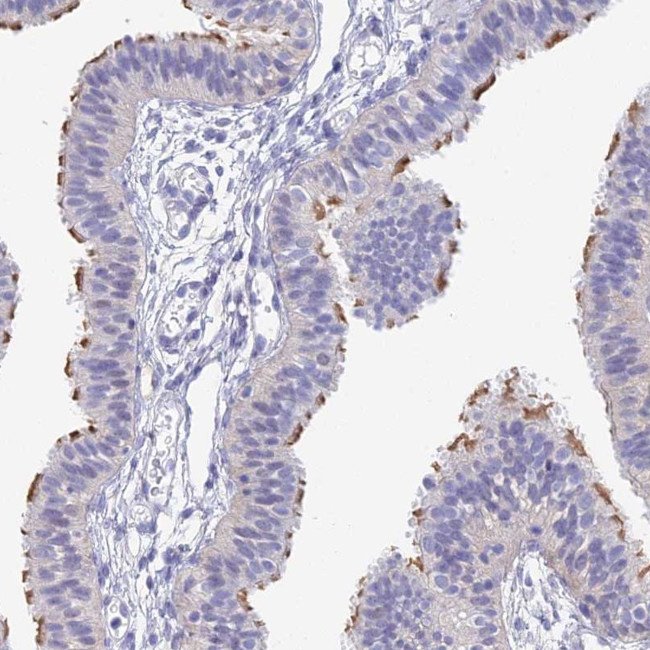 DNAH14 Antibody in Immunohistochemistry (Paraffin) (IHC (P))