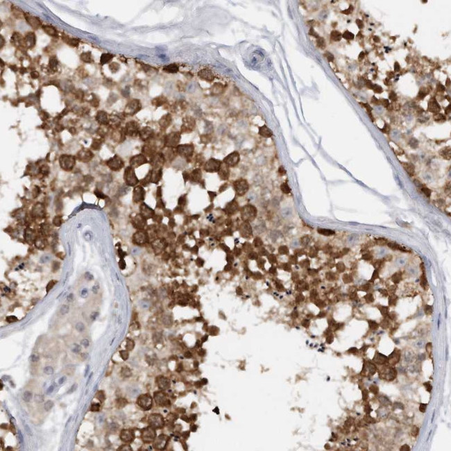 DDX43 Antibody in Immunohistochemistry (Paraffin) (IHC (P))
