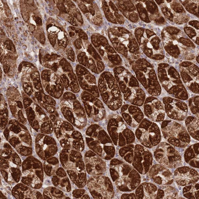 PREP Antibody in Immunohistochemistry (Paraffin) (IHC (P))
