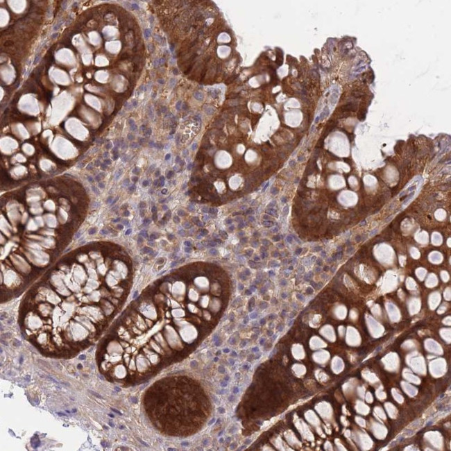 PREP Antibody in Immunohistochemistry (Paraffin) (IHC (P))