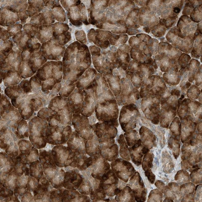 RMND1 Antibody in Immunohistochemistry (Paraffin) (IHC (P))