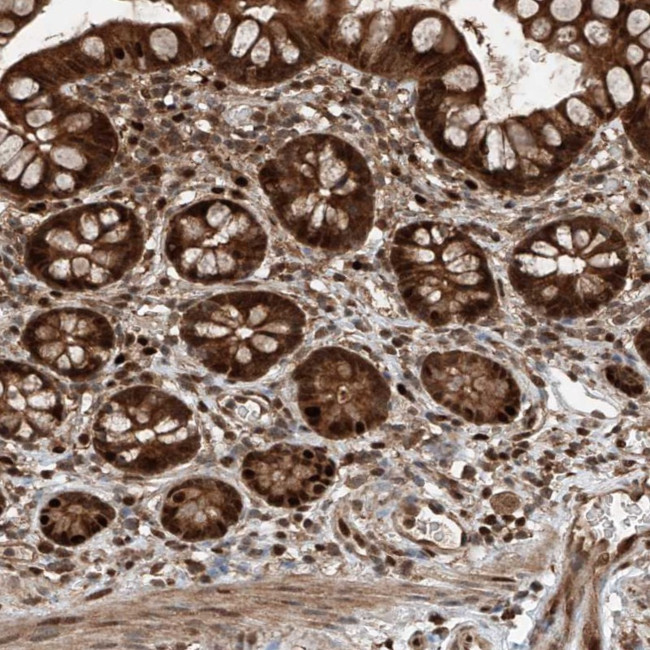 RMND1 Antibody in Immunohistochemistry (Paraffin) (IHC (P))