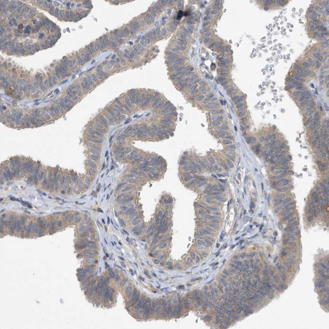 LAPTM4A Antibody in Immunohistochemistry (IHC)