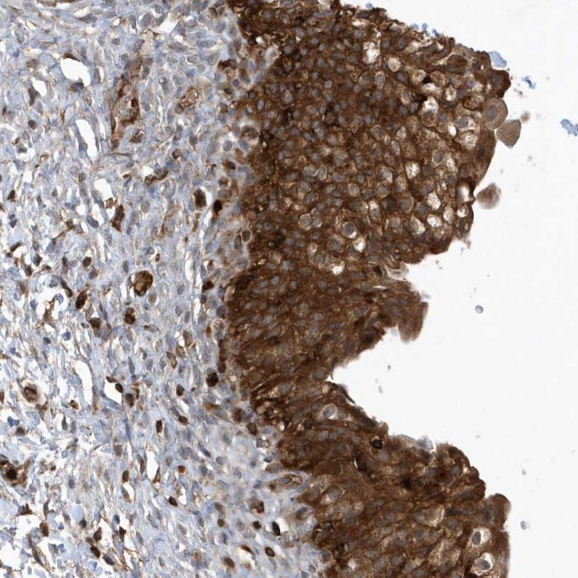 LAPTM4A Antibody in Immunohistochemistry (Paraffin) (IHC (P))
