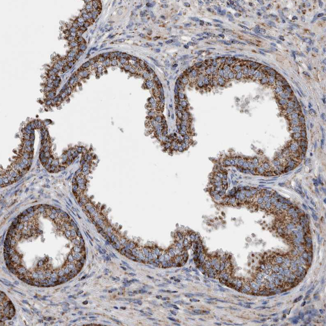 WFDC1 Antibody in Immunohistochemistry (Paraffin) (IHC (P))