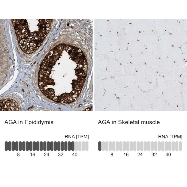 AGA Antibody in Immunohistochemistry (IHC)