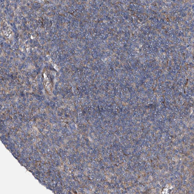 SPATA20 Antibody in Immunohistochemistry (Paraffin) (IHC (P))