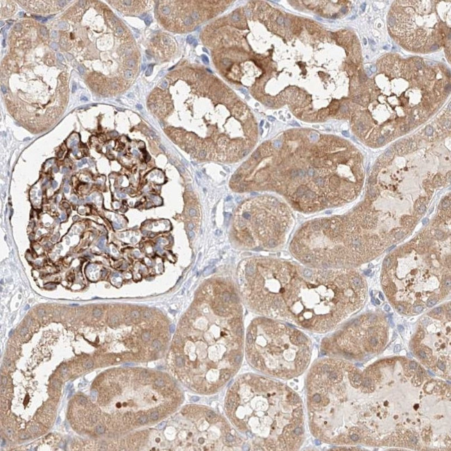GLMN Antibody in Immunohistochemistry (IHC)