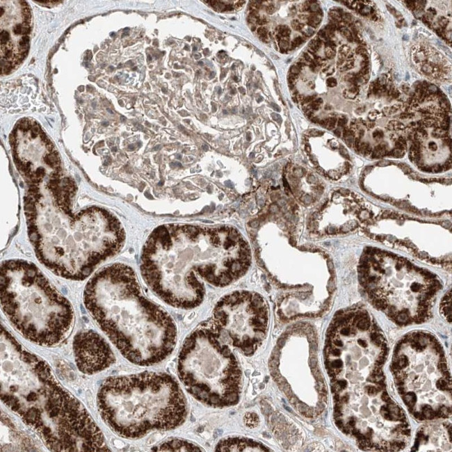 ZNF620 Antibody in Immunohistochemistry (Paraffin) (IHC (P))