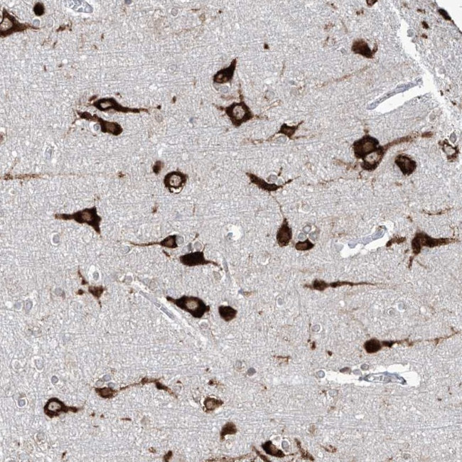 FAM83B Antibody in Immunohistochemistry (Paraffin) (IHC (P))