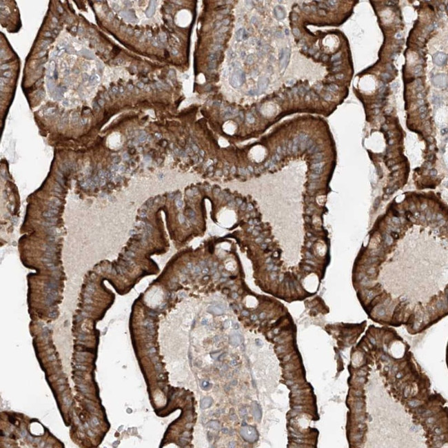 CAZIP Antibody in Immunohistochemistry (Paraffin) (IHC (P))