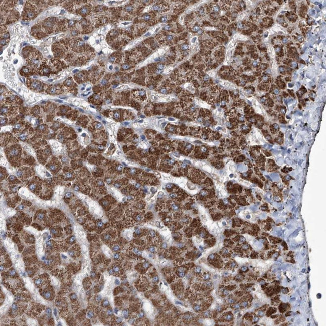 NHS Antibody in Immunohistochemistry (Paraffin) (IHC (P))