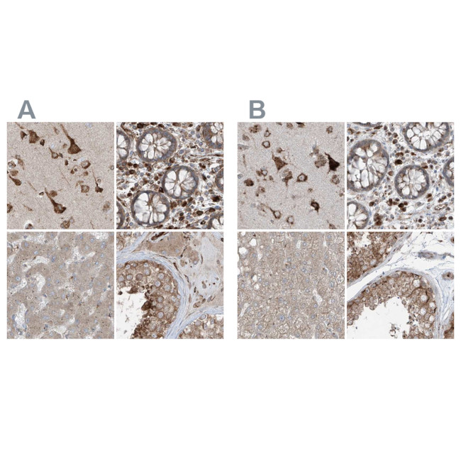 XTP3B Antibody in Immunohistochemistry (IHC)