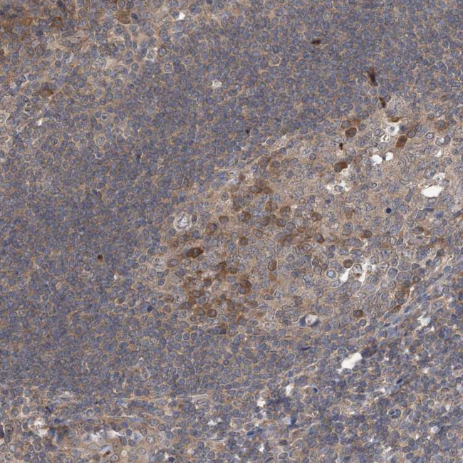 STK19 Antibody in Immunohistochemistry (Paraffin) (IHC (P))
