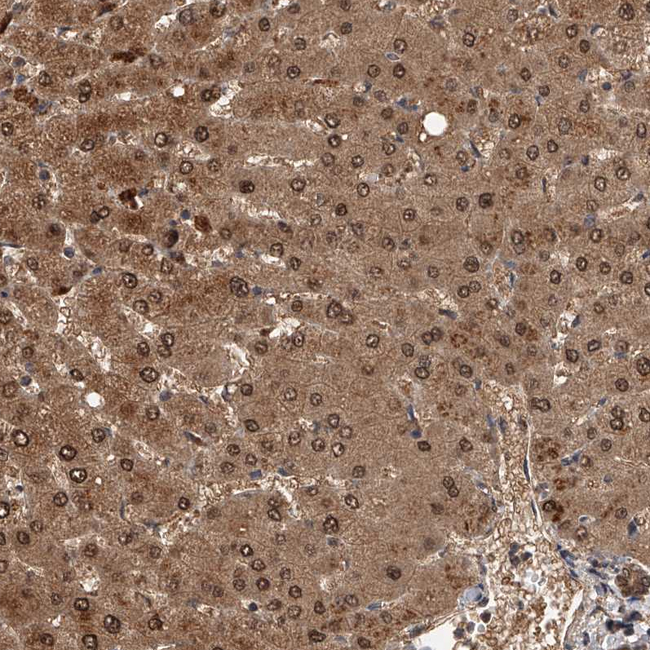 GMDS Antibody in Immunohistochemistry (Paraffin) (IHC (P))