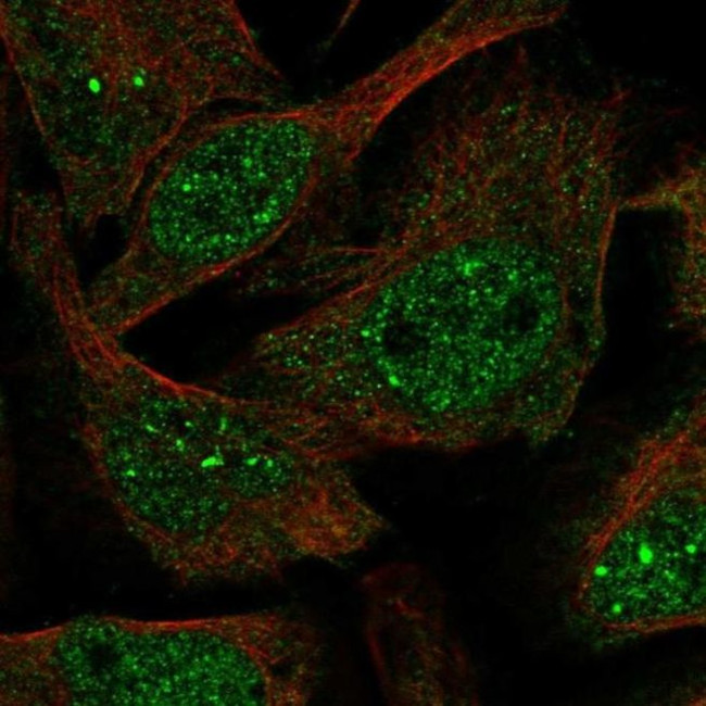 KIAA1429 Antibody in Immunocytochemistry (ICC/IF)