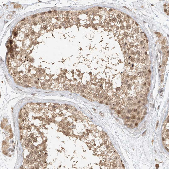 CXorf58 Antibody in Immunohistochemistry (Paraffin) (IHC (P))