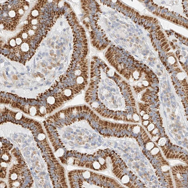 CXorf58 Antibody in Immunohistochemistry (Paraffin) (IHC (P))